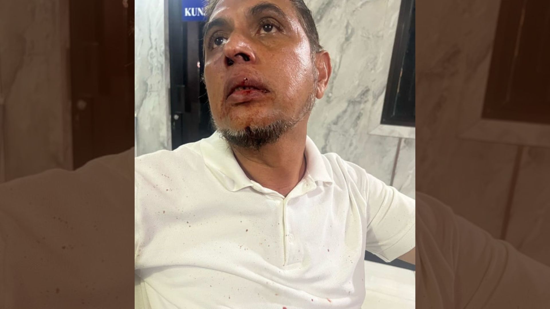 Alami Intimidasi, Ustaz Habib Abdul Hakim Dipukul Hingga Bibirnya Berdarah